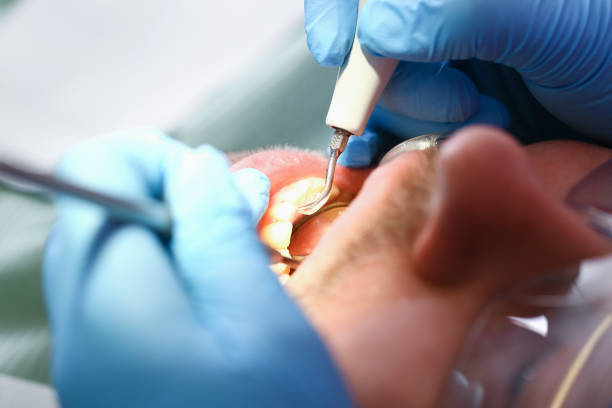 Best Cosmetic Emergency Dentistry in Stony Point, MI