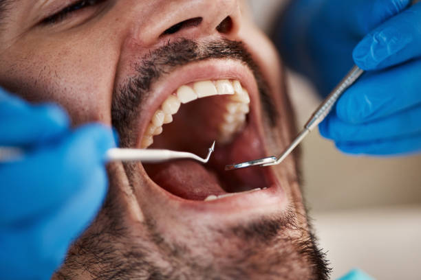 Best Emergency Dental Care for Broken or Chipped Teeth in Stony Point, MI