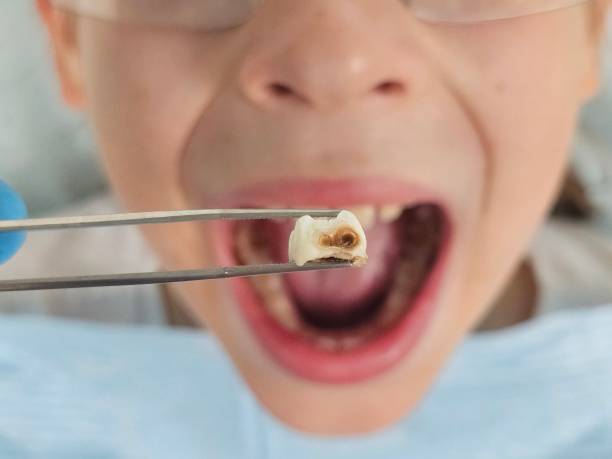 Best Same-Day Emergency Dental Services in Stony Point, MI